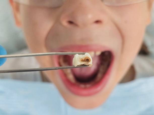 Best Urgent Dental Care for Toothache in Bouse, AZ